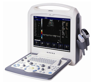 便携式彩超